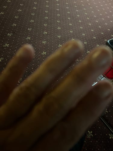 Customer photo review of Rocket Nail Fuel Nail Repair - Clear