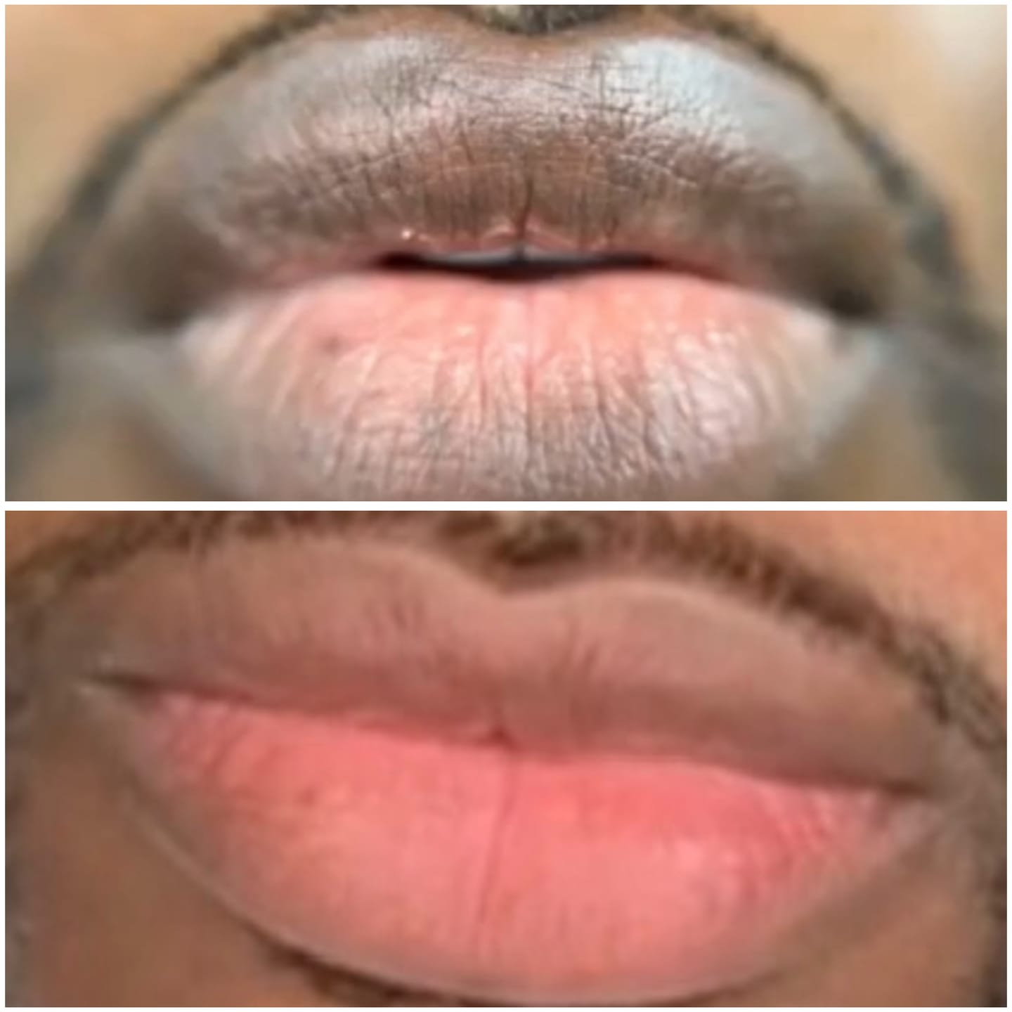 Customer photo review of Pink Lip Kit