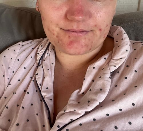 Customer photo review of Cream & Serum Trial Kit