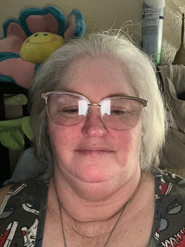 Customer photo review of Semaglutide Weight Loss Program