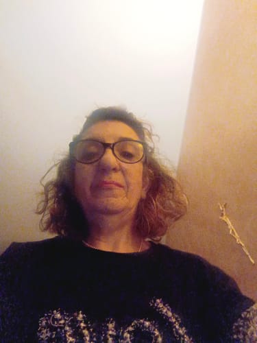 Customer photo review of Sieri Acido Ialuronico + Vitamina C + Bava di Lumaca - 3 al Prezzo di 1 (30ml per Siero)