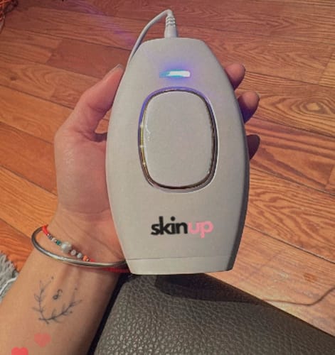 Customer photo review of SkinUp Clásica