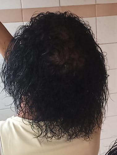 Customer photo review of Hair & Nail Capsules