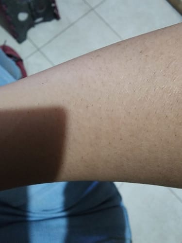 Customer photo review of SkinUp Clásica