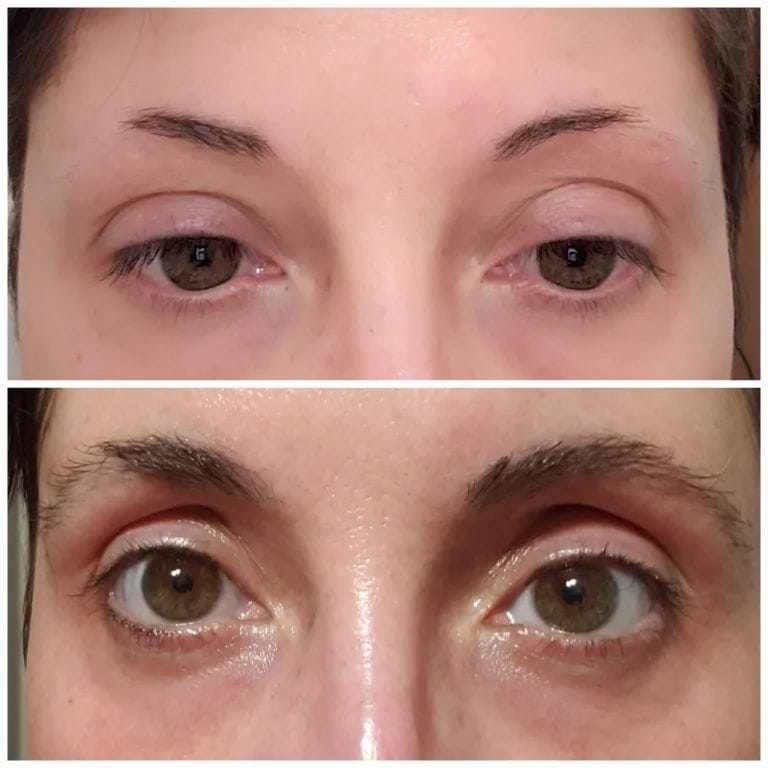 Customer photo review of IZABELL ROLLER - רולר לצמיחת הגבות מחדש