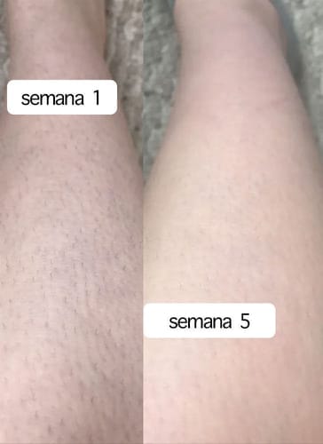 Customer photo review of SkinUp Clásica