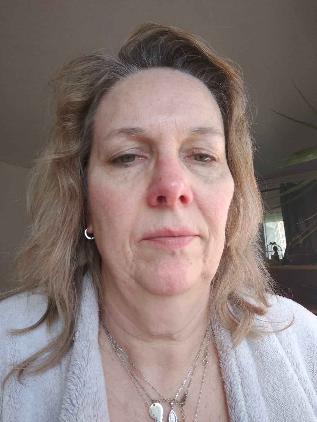 Customer photo review of Beauty of Joseon - Sérum pour les yeux - Revive Eye Serum Ginseng & Retinal