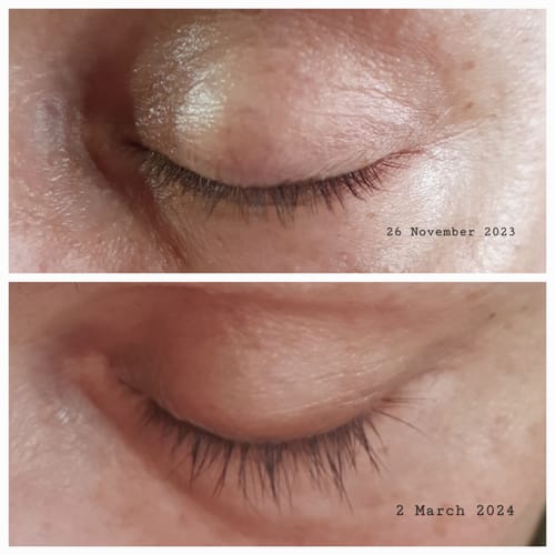 Customer photo review of LASH GROWTH SERUM