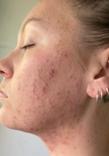 Customer photo review of Advanced Reset Program™