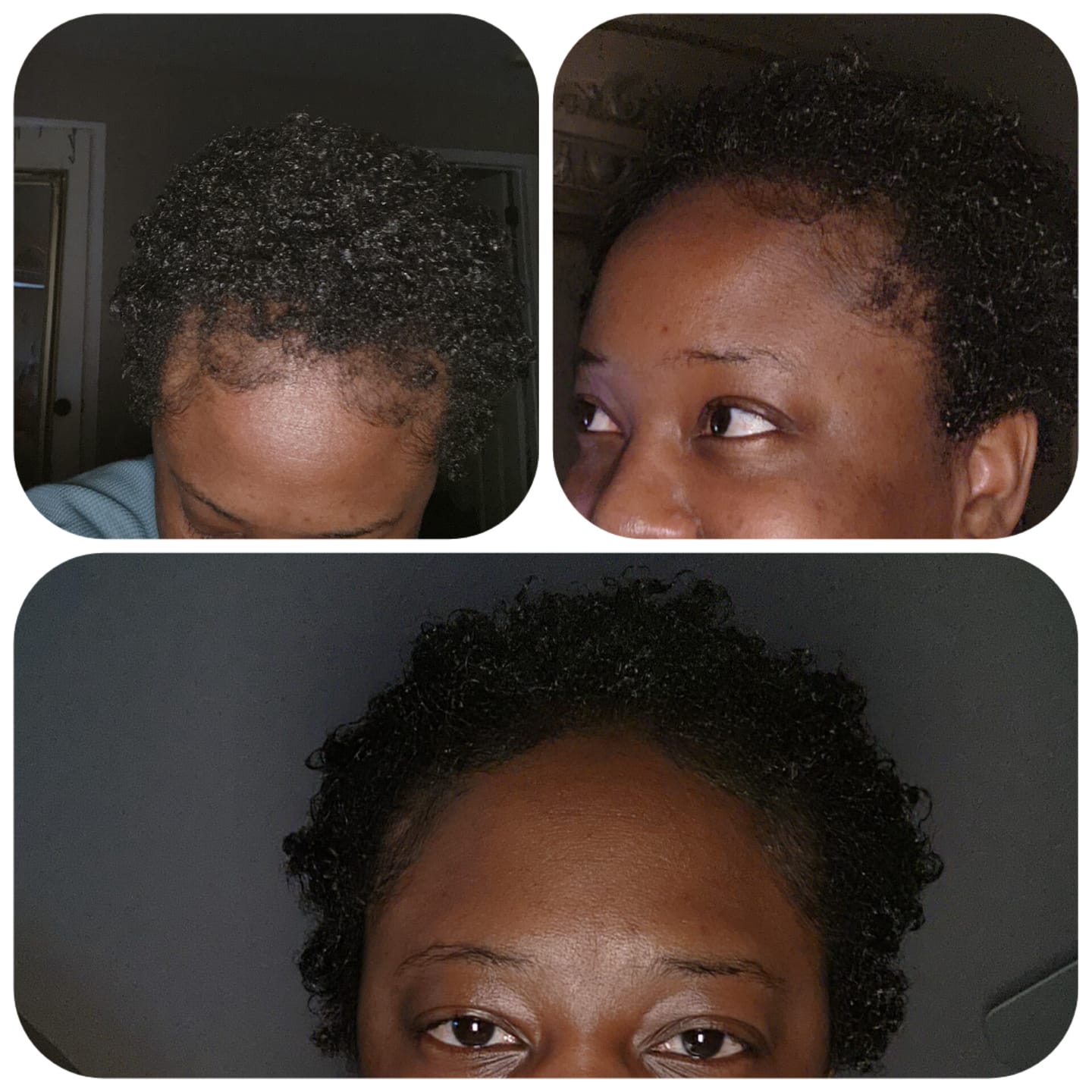Customer photo review of INDULGE Moisturizing Deep Conditioning Treatment
