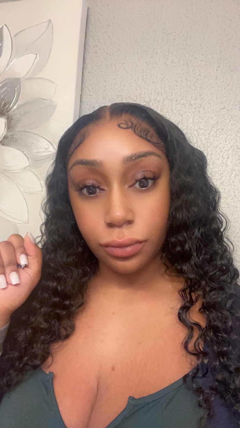 Customer photo review of Vitamin C Serum  (High Potency)