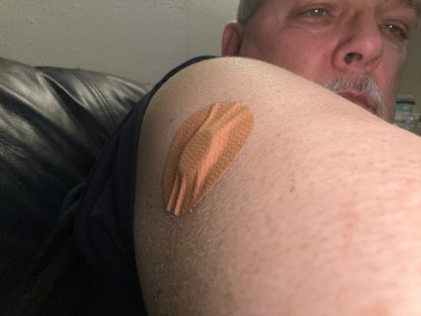 Customer photo review of Skin Grip MAX Freestyle Libre 3 Patches