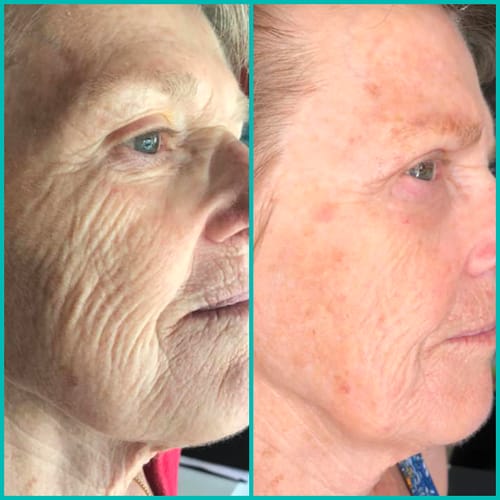 Customer photo review of Crème Anti Cernes et Rides Instantanée