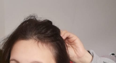 Customer photo review of HairGrowth / Ginger Hair Regrowth Shampoo Bar