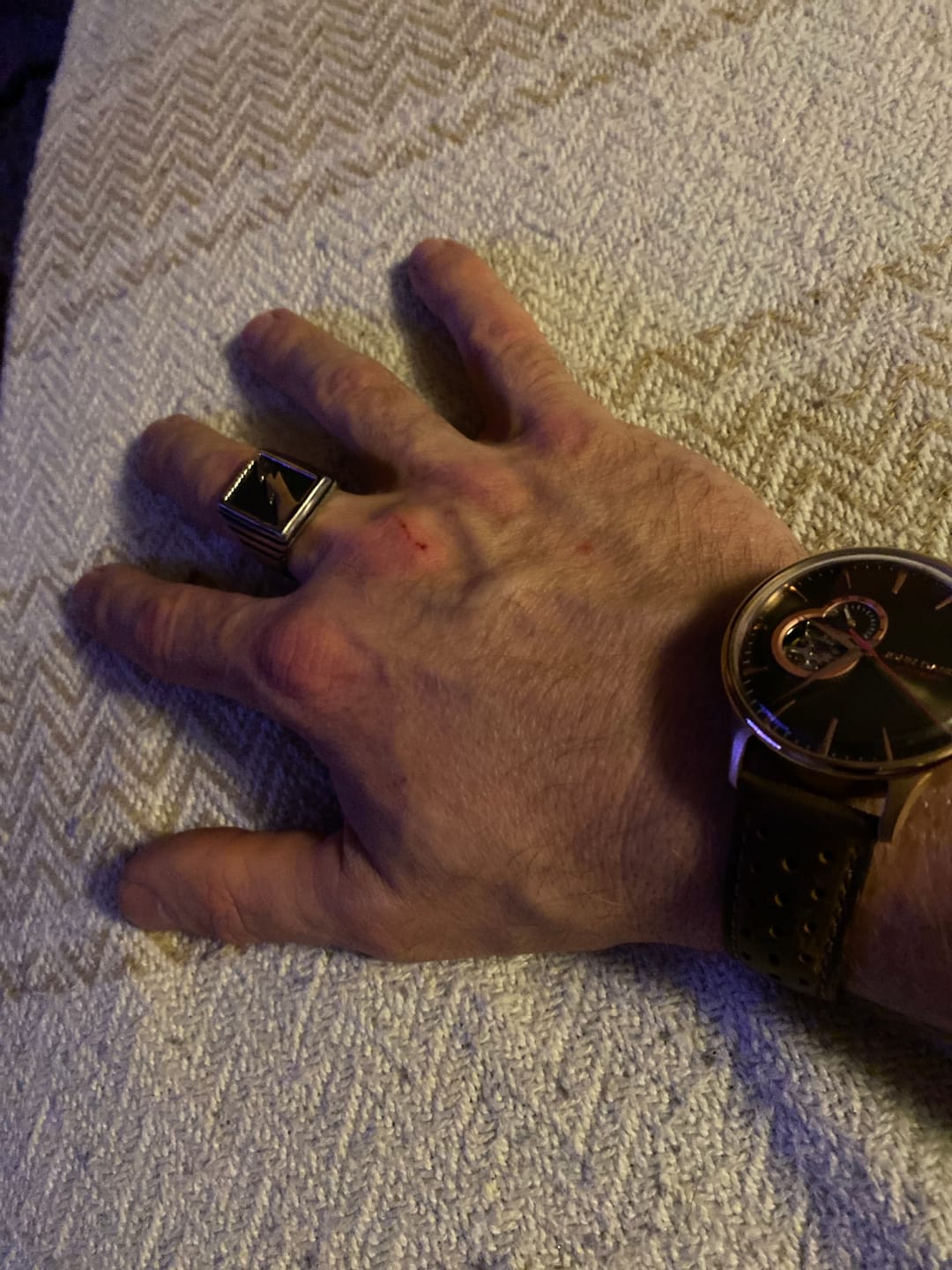 Customer photo review of LIGHTNING.