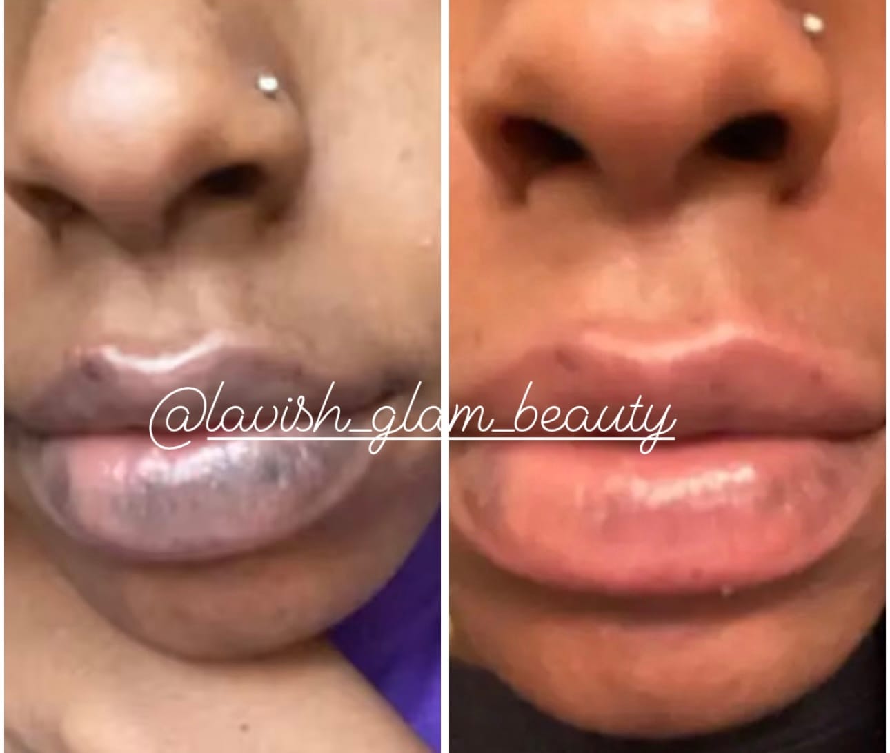 Customer photo review of Pink Lip Kit