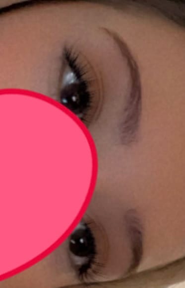 Customer photo review of Eyeling Custom Lens (1 month)