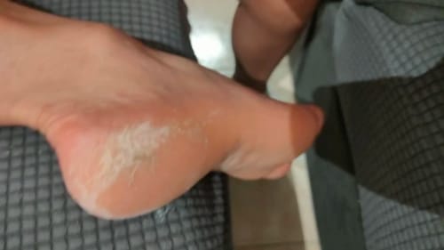 Customer photo review of Electric Callus and Dead Skin Remover Rechargeable Foot File Pedicure Tool