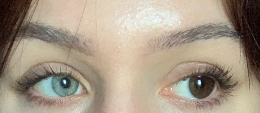 Customer photo review of Eyeling Custom Lens (1 month)