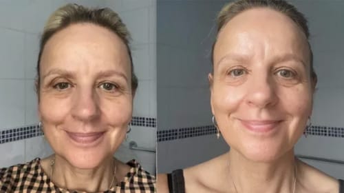 Customer photo review of Varita Infinite Glow & Serum Activador