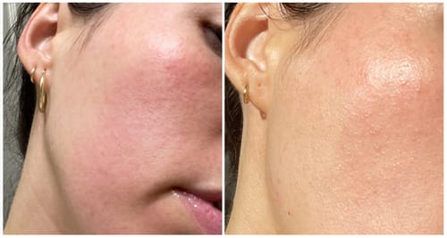 Customer photo review of Varita Infinite Glow & Serum Activador