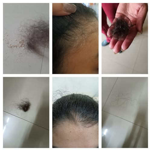 Customer photo review of Dandruff Defence - Hair Oil - Single
