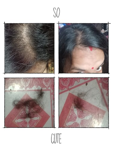 Customer photo review of Dandruff Defence - Hair Oil - Single