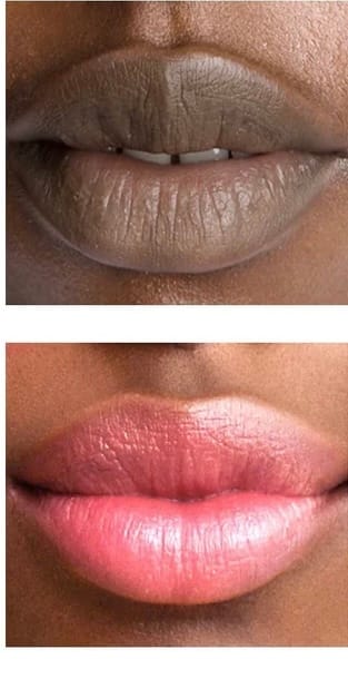 Customer photo review of Pink Lip Kit