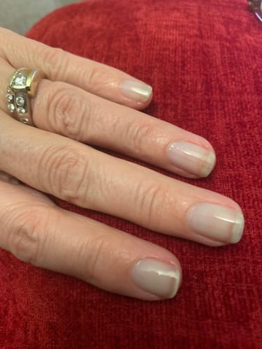 Customer photo review of Rocket Nail Fuel Nail Repair - Clear