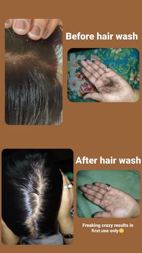 Customer photo review of Champi Rituals - Hair Oil