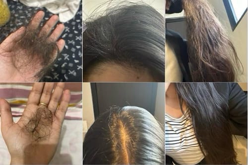 Customer photo review of Dandruff Defence - Hair Oil - Single