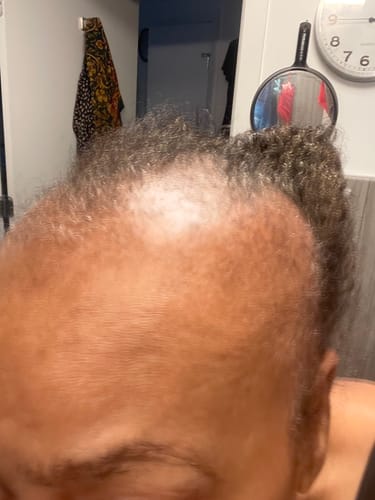 Customer result
