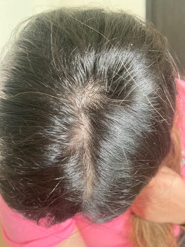 Customer photo review of Champi Rituals - Hair Oil