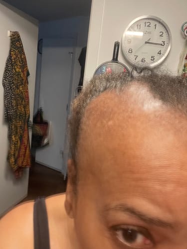 Customer result
