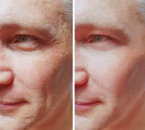 Customer photo review of Marine Collagen Eye Repair Gels