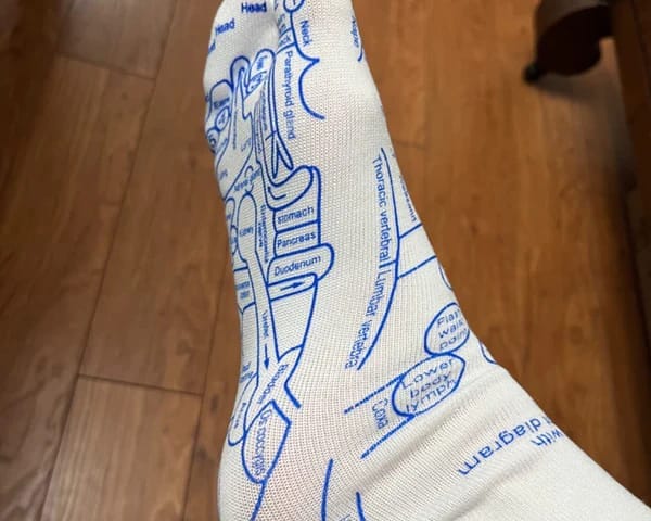 Customer photo review of SALUDEA Reflexology Socks Set