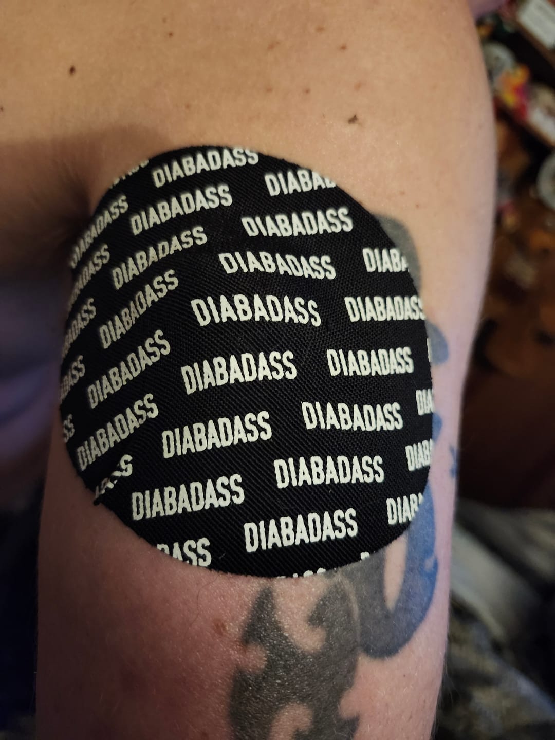 Customer photo review of Skin Grip Original - Medtronic Guardian/Enlite Adhesive Patches - 20 Pack