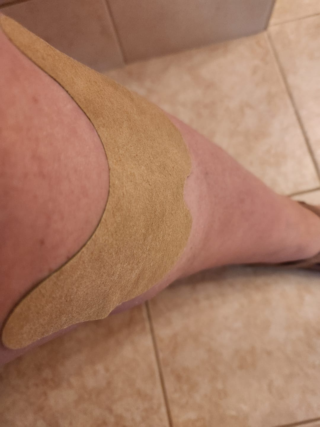 Customer photo review of Auxillium Knee Patch (fka Heaven Patch)