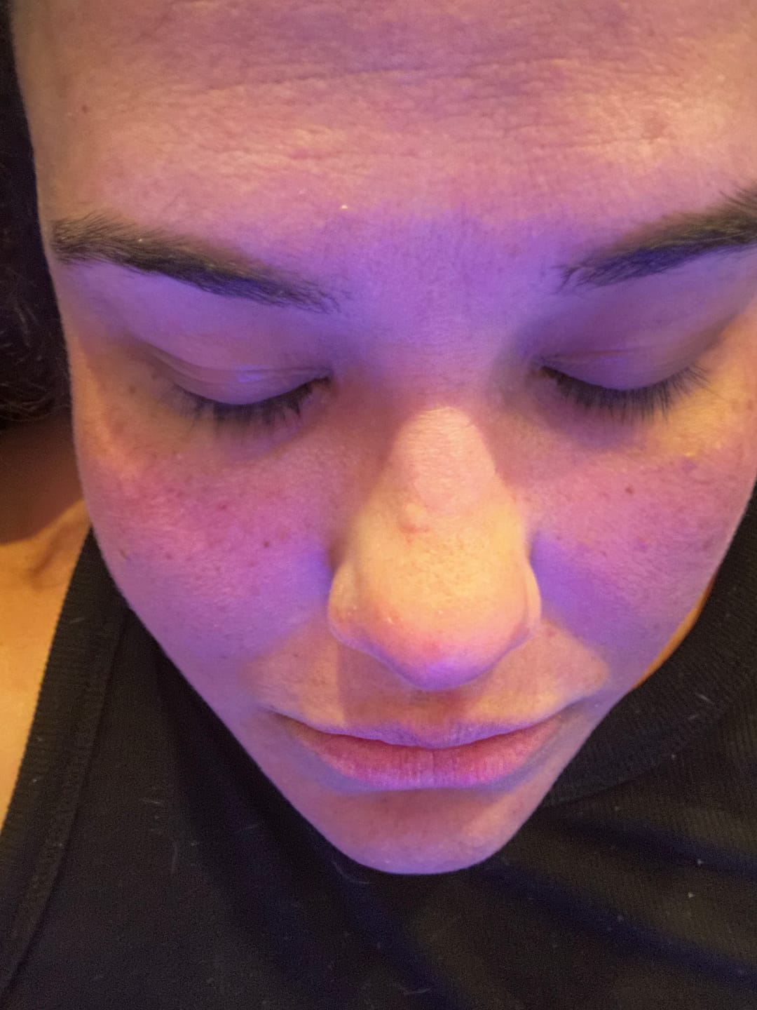 Customer photo review of Back in stock Honey Skin Smoothing Exfoliator