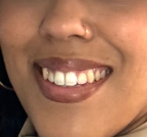 Customer photo review of Coffret cadeau : 4 faux piercings au nez