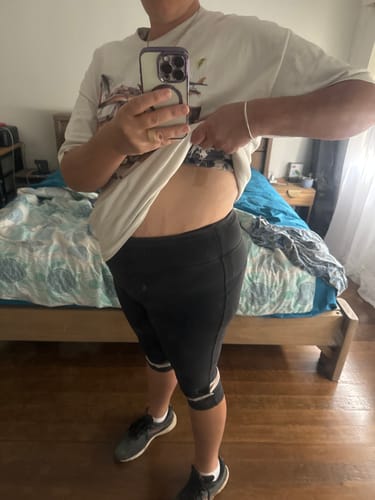 Customer photo review of Mood Patch