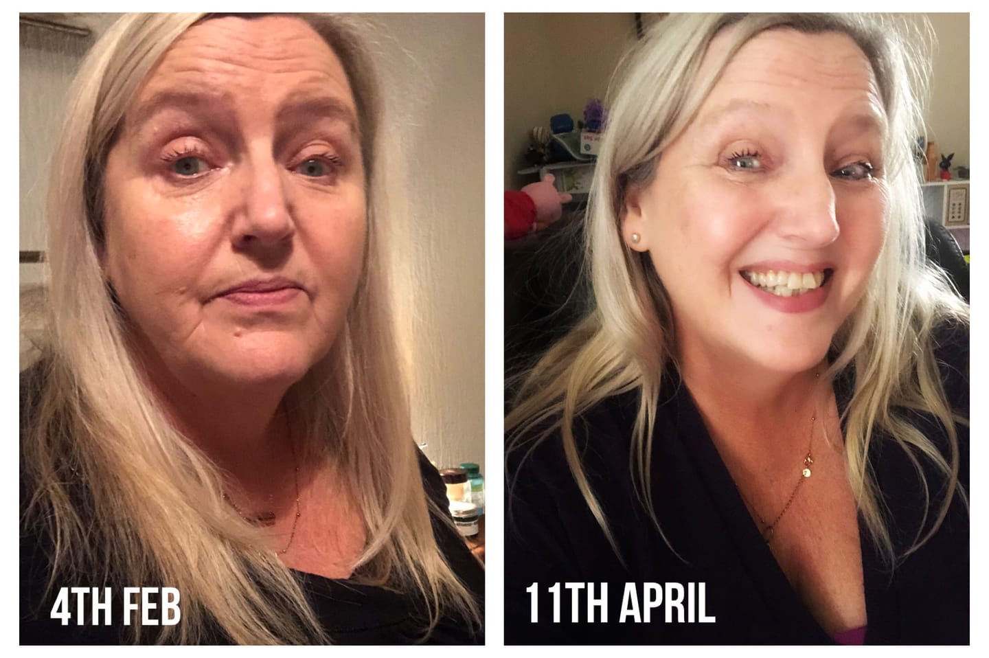 Customer photo review of CollaSlim Meal Replacement Shake With Collagen Protein