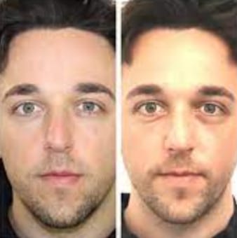 Customer photo review of Skin Guard Stem Cell Moisturizer