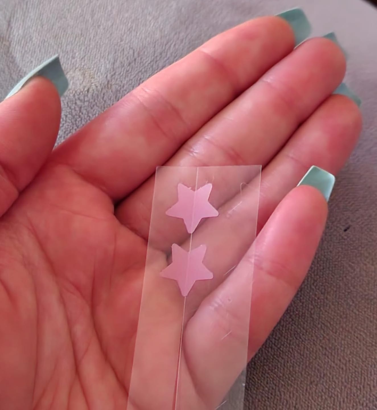 Customer photo review of 240 CT Mixed Superstar Pimple Patches w/Salicylic Acid & Tea Tree Oil