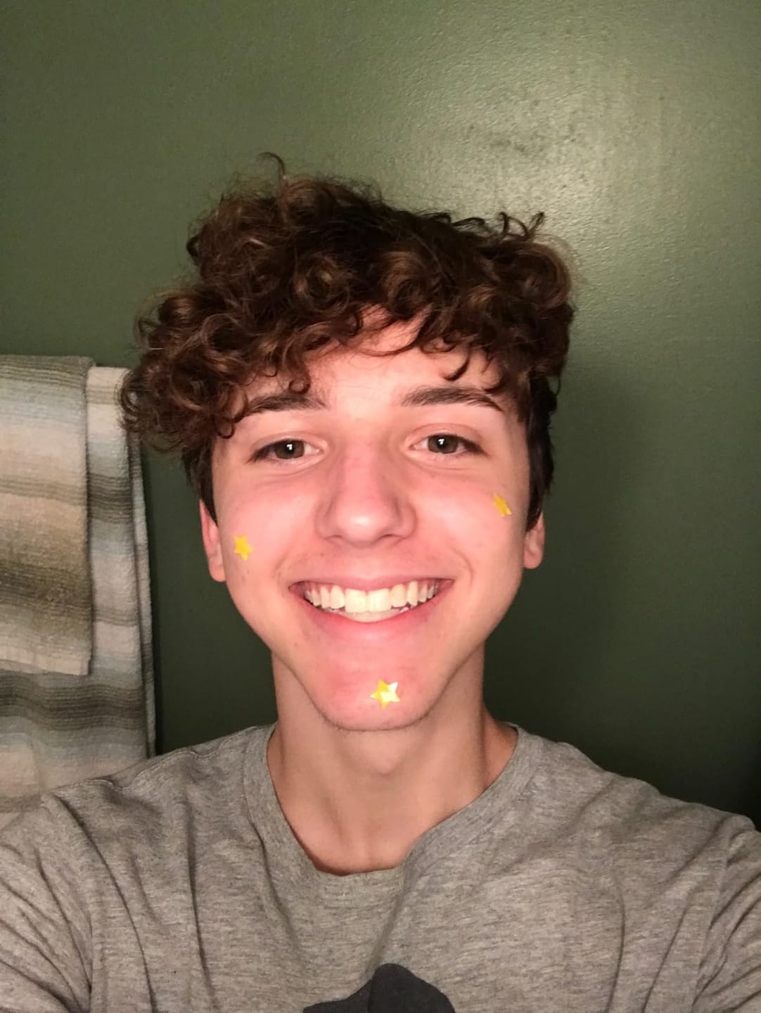 Customer photo review of 240 CT Mixed Superstar Pimple Patches w/Salicylic Acid & Tea Tree Oil
