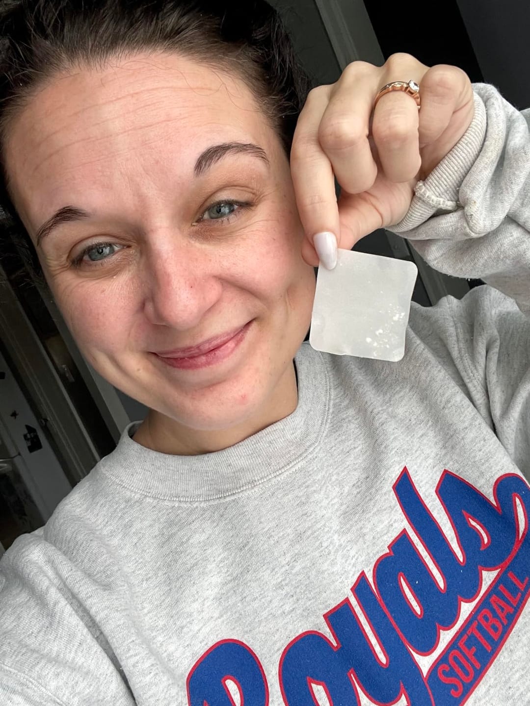 Customer photo review of 272 CT Pimple Patches Variety Pack w/ Tea Tree Oil, Salicylic Acid & Calendula Oil