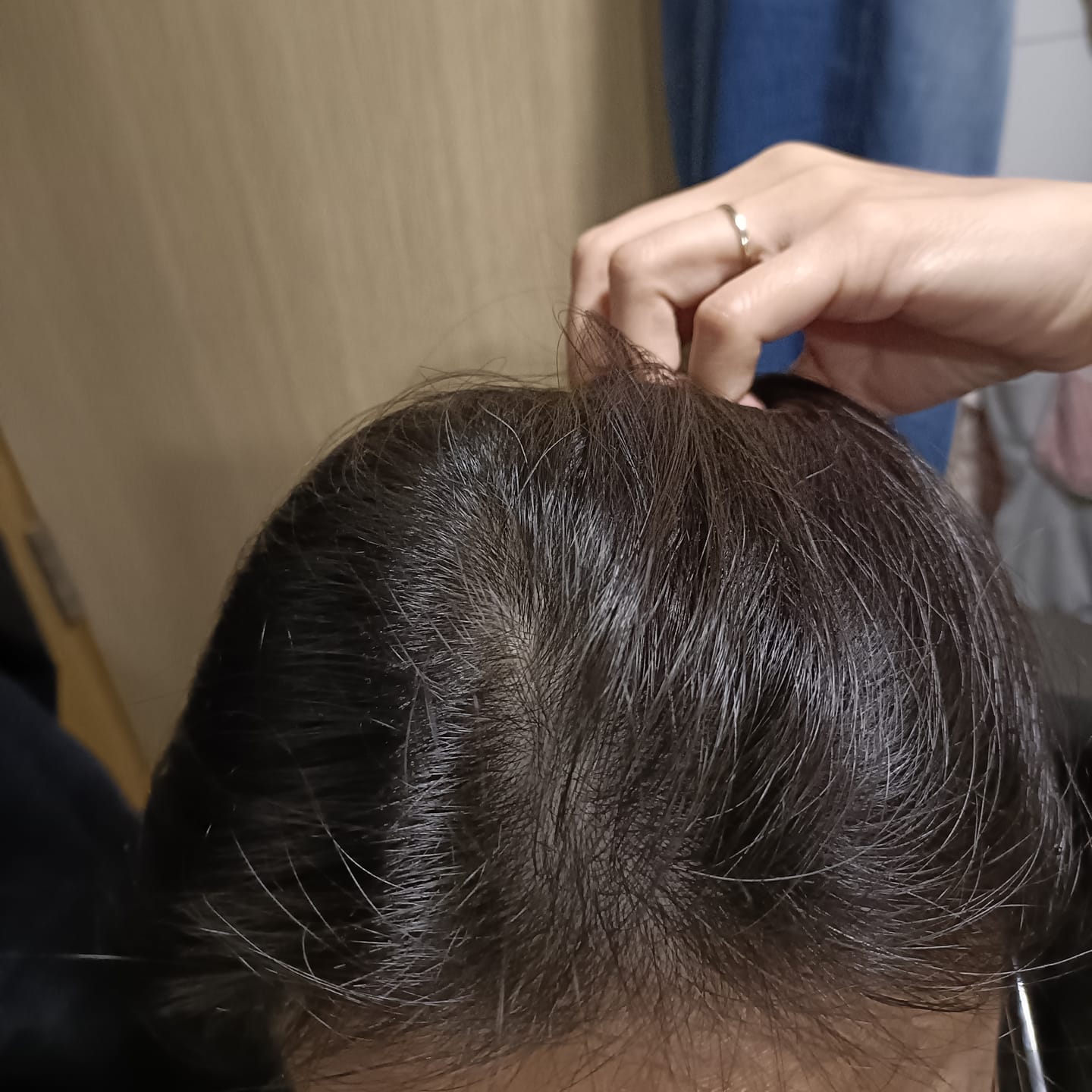 Customer photo review of [ SMIB ] - 500ML Coral Calcium Treatment