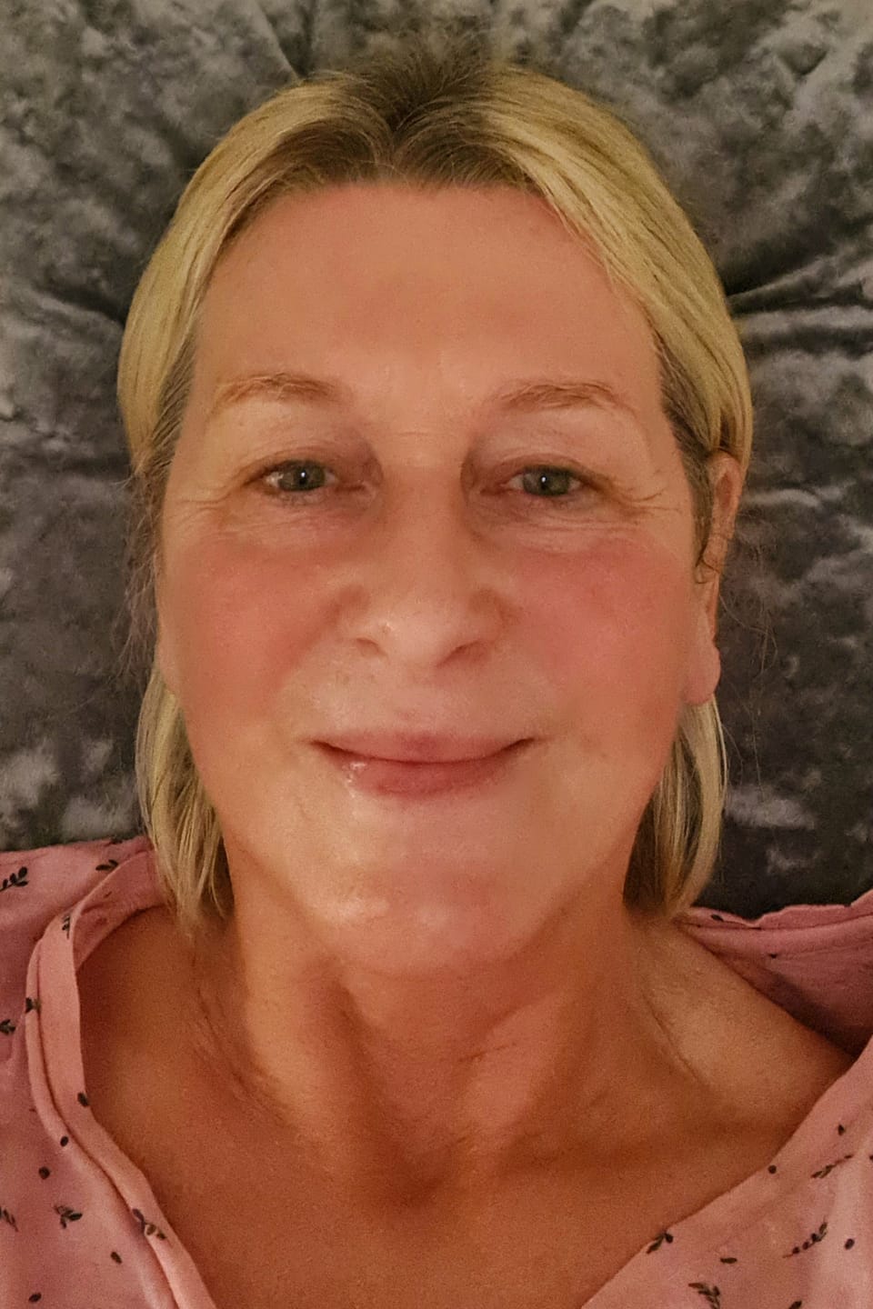 Customer photo review of Scar Minimising Oil