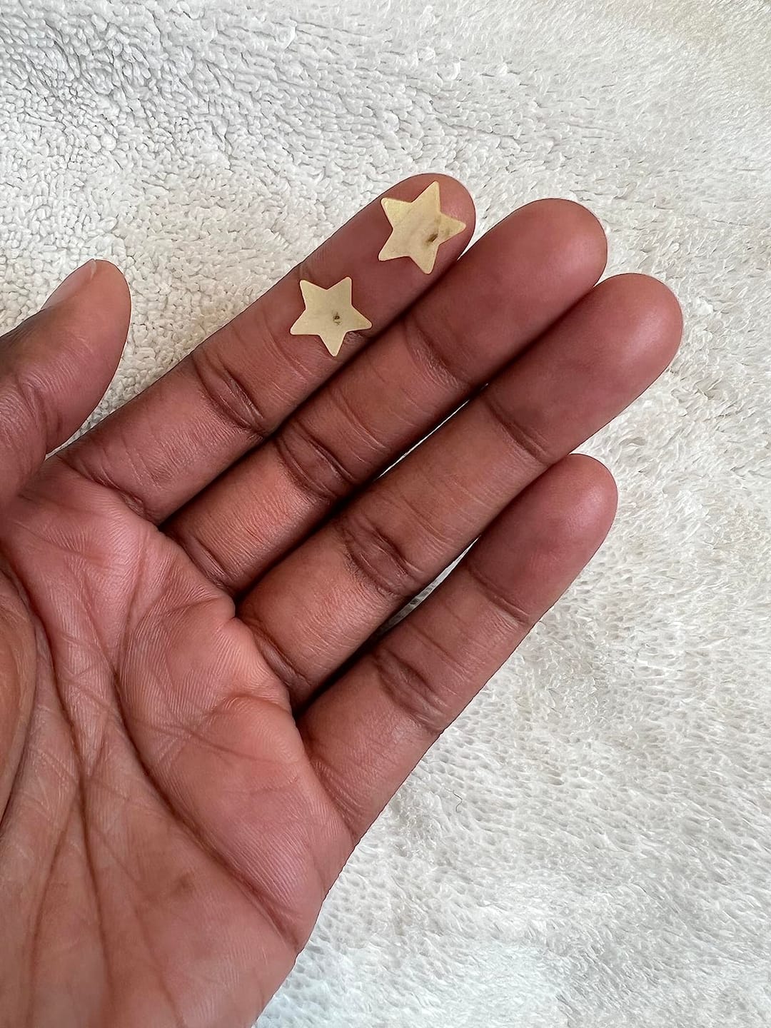 Customer photo review of 240 CT Mixed Superstar Pimple Patches w/Salicylic Acid & Tea Tree Oil