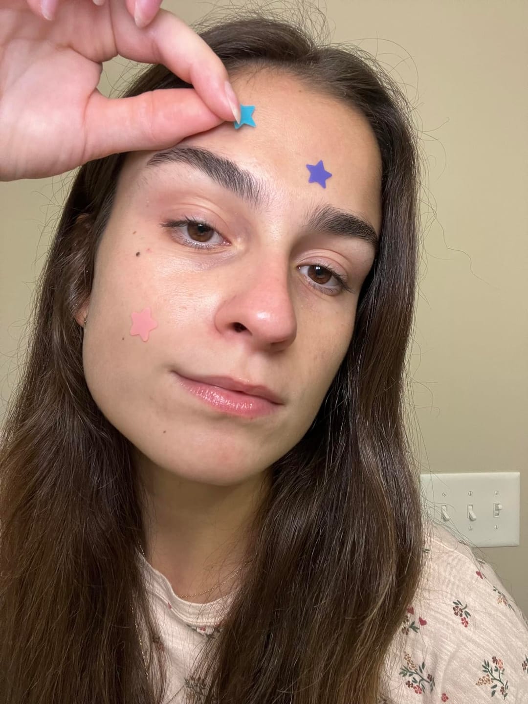 Customer photo review of 240 CT Mixed Superstar Pimple Patches w/Salicylic Acid & Tea Tree Oil